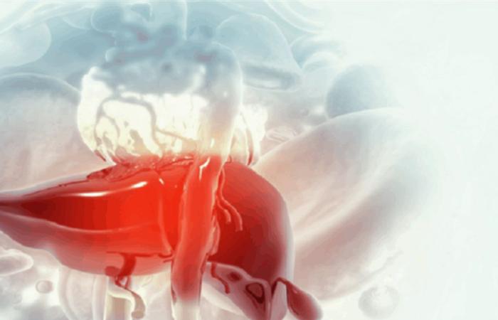 عادات وأسباب قد تدمّر الكبد.. ما هي؟
