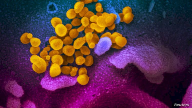 دراسة تفجر مفاجأة.. الكوليسترول “الجيد” ليس جيداً دراسة-تفجر-مفاجأة.-الكوليسترول-“الجيد”-ليس-جيداً