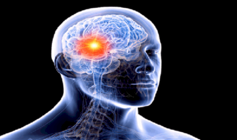 مسمار اخترق عينه واستقر في دماغه.. هكذا أنقذه الأطباء مسمار-اخترق-عينه-واستقر-في-دماغه.-هكذا-أنقذه-الأطباء