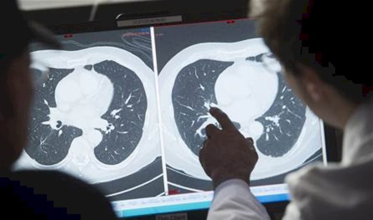 ابنة نجم رياضي شهير أعلنت إصابتها به… ما هو الورم الأرومي النخاعي؟ ابنة-نجم-رياضي-شهير-أعلنت-إصابتها-به…-ما-هو-الورم-الأرومي-النخاعي؟