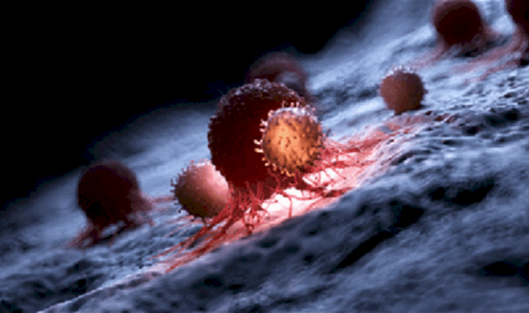 دراسة مقلقة: السرطان أصبح يصيب الشباب في كل أنحاء العالم دراسة-مقلقة:-السرطان-أصبح-يصيب-الشباب-في-كل-أنحاء-العالم