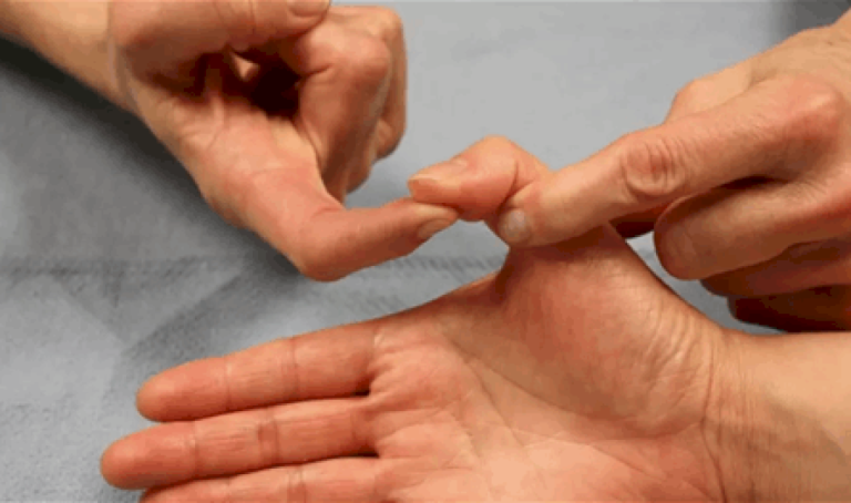 كيف يمكن لأصابع اليد أن تكشف عن المرضى النفسيين؟ كيف-يمكن-لأصابع-اليد-أن-تكشف-عن-المرضى-النفسيين؟