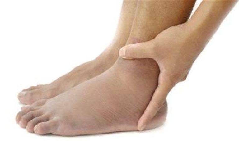 طرق منزلية فعاله في علاج تورم الاصابع في الشتاء طرق-منزلية-فعاله-في-علاج-تورم-الاصابع-في-الشتاء