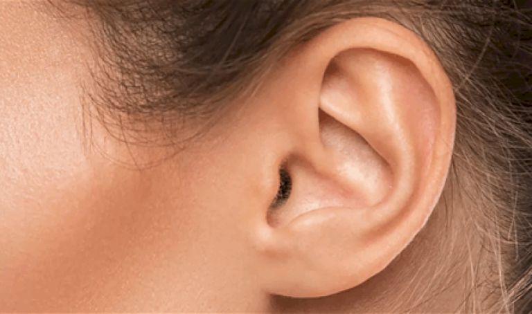 شمع-الأذن-قد-يكون-مؤشرا-على-هذه-الأمراض.-إليكم-التفاصيل