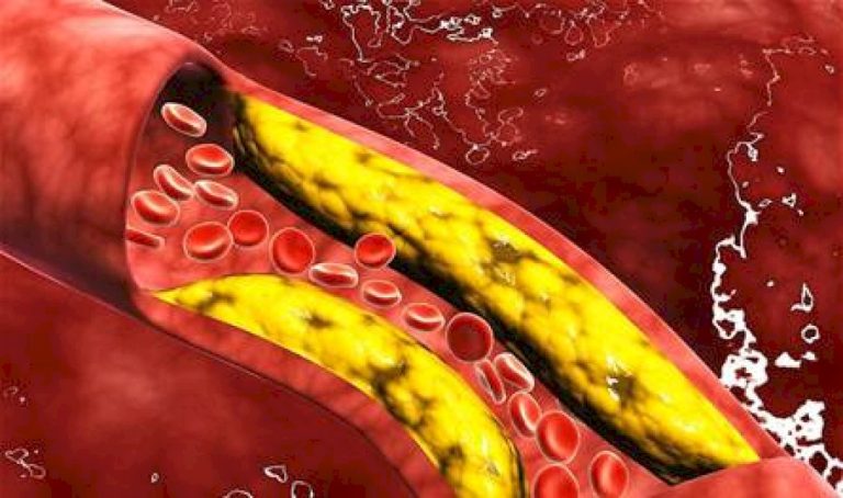 دواء-للكوليسترول-"مهم-جداً".-دراسة-تكشف-عنه-الكثير