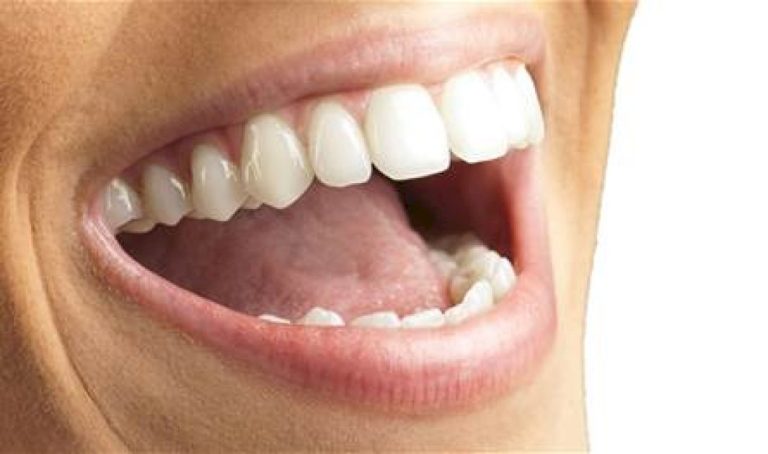 كيف تحافظ على صحة أسنانك أثناء الصيام؟ كيف-تحافظ-على-صحة-أسنانك-أثناء-الصيام؟