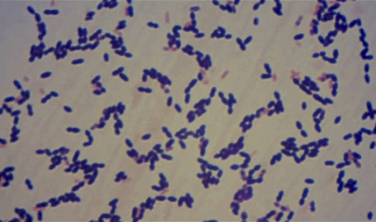 شديدة العدوى… بكتيريا قاتلة تنتشر بشكل قياسي من هم الأكثر عرضة للإصابة بها؟ شديدة-العدوى…-بكتيريا-قاتلة-تنتشر-بشكل-قياسي-من-هم-الأكثر-عرضة-للإصابة-بها؟