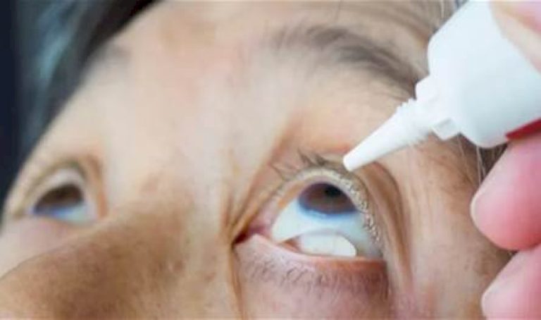 جفاف العين.. أسبابه وطرق علاجه جفاف-العين.-أسبابه-وطرق-علاجه