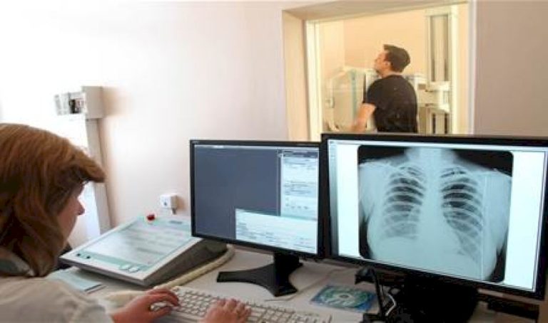 هل من علاقة بين السل وخطر الإصابة بالسرطان؟ هل-من-علاقة-بين-السل-وخطر-الإصابة-بالسرطان؟