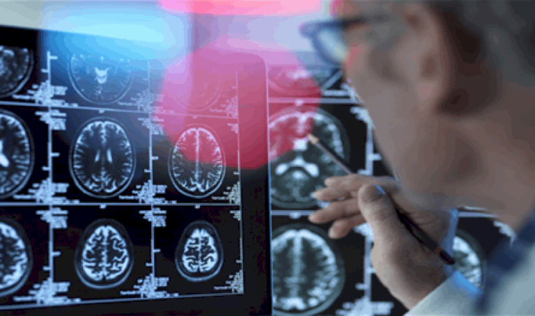 فن الامتنان.. مفتاح الحفاظ على صحة الدماغ فن-الامتنان.-مفتاح-الحفاظ-على-صحة-الدماغ