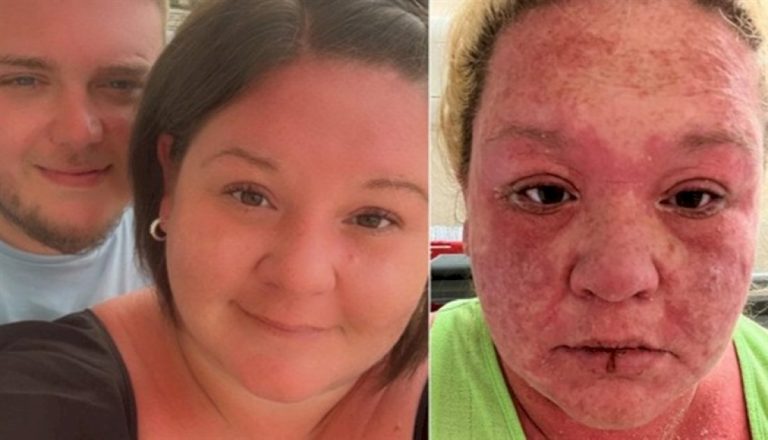 بعوضة-تفسد-رحلة-عاشقين-بريطانيين