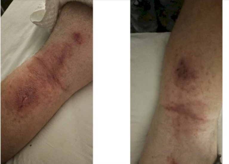 نبات الخنزير يغير الحمض النووي لأمريكي نبات-الخنزير-يغير-الحمض-النووي-لأمريكي