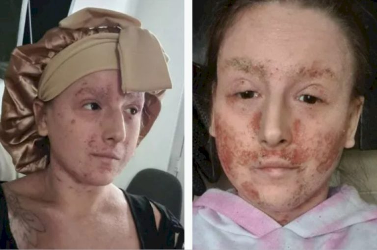 بريطانية-تعيش-بـ-جلد-سحلية-منذ-طفولتها