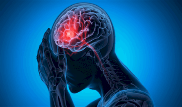 الأطباء قلقون… نوع جديد من الفطريات يهاجم الدماغ البشري الأطباء-قلقون…-نوع-جديد-من-الفطريات-يهاجم-الدماغ-البشري