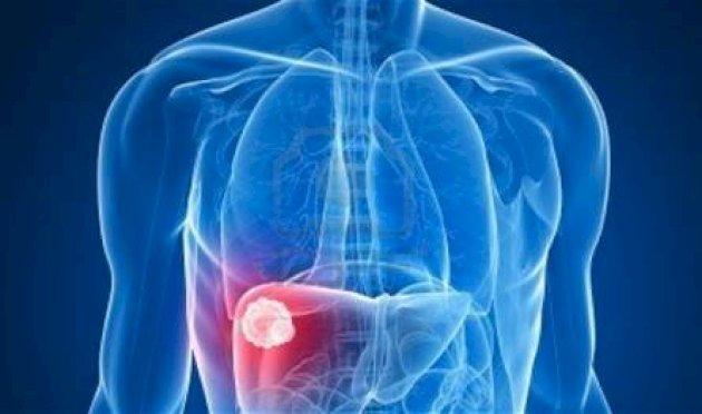 خطوة-جديدة-نحو-علاج-فعال-لتلف-الكبد-الناتج-عن-المسكنات…-إليكم-التفاصيل