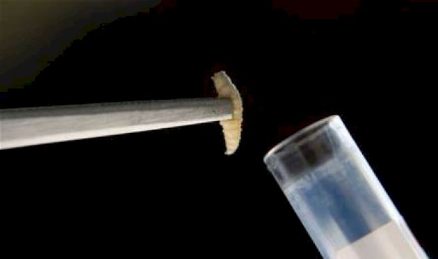 بعد تسجيل أول إصابة بشرية في أميركا.. ماذا نعرف عن داء الدودة الحلزونية؟ بعد-تسجيل-أول-إصابة-بشرية-في-أميركا.-ماذا-نعرف-عن-داء-الدودة-الحلزونية؟