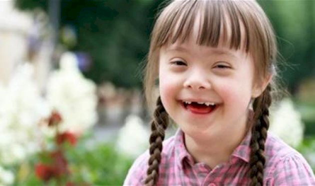 اختراق-علمي.-حذف-كروموسوم-زائد-يفتح-الباب-لعلاج-متلازمة-داون