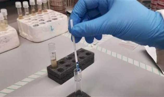 ارتفاع-حالات-الإصابة-بالكوليرا-في-العالم.-وتحذير-دولي