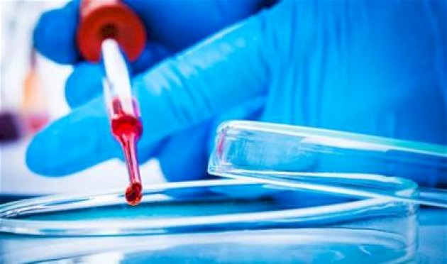 خزعة.. تكشف السرطان قبل 10 سنوات من ظهور الأعراض خزعة.-تكشف-السرطان-قبل-10-سنوات-من-ظهور-الأعراض