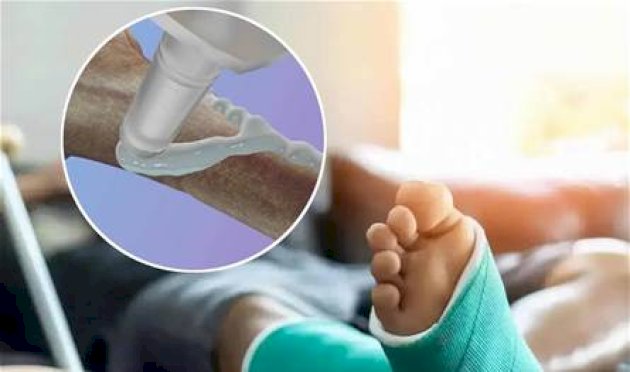 اختراع-صيني:-"غراء-عظام"-يلتئم-في-3-دقائق