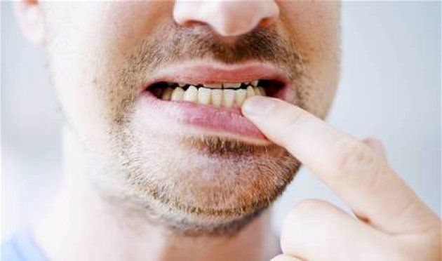 نظام-غذائي-شهير-يقلل-التهابات-اللثة.-ما-هو؟