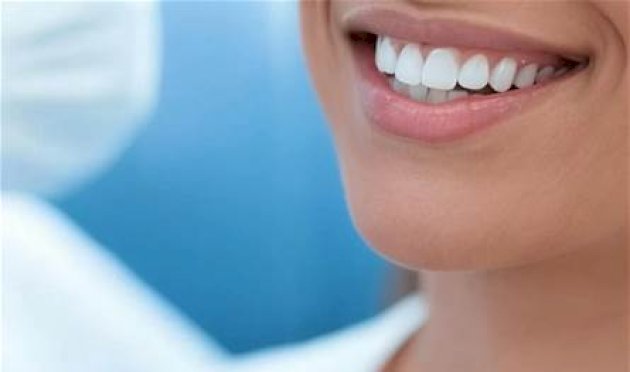 حيل-تبييض-الأسنان.-خبراء-يحذرون-من-أضرار-خطيرة-على-المينا