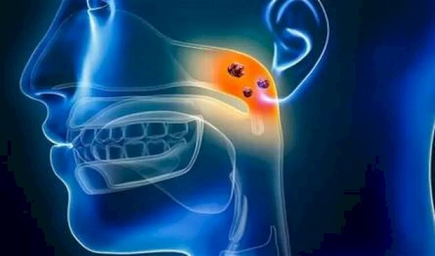 بعد انتشاره في احدى الدول العربية.. ماذا تعرف عن داء الدفتيريا؟ بعد-انتشاره-في-احدى-الدول-العربية.-ماذا-تعرف-عن-داء-الدفتيريا؟