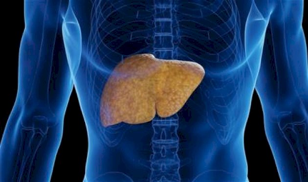 الكبد-الدهني-يتفشّى.-اكتشف-طرق-الوقاية