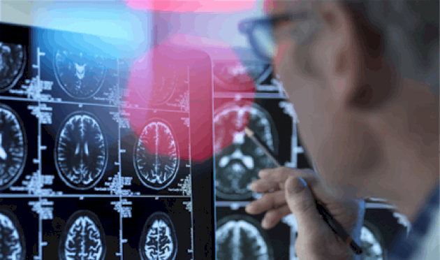 كم-يعيش-المصاب-بالخرف؟