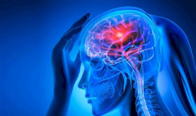 في-اليوم-العالمي-للسكتة-الدماغية…-تحذير-من-علامات-مبكرة-قد-تنقذ-حياتك