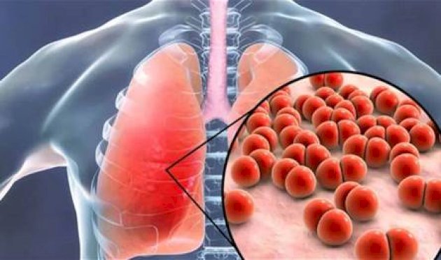 خطوة-بحثية-واعدة:-لقاح-جديد-ضد-السّل-قيد-التطوير
