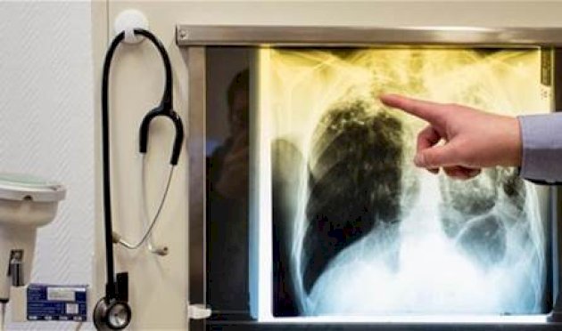 العلم-يقترب-من-التغلب-على-أخطر-مرض-في-العالم.-اليكم-التفاصيل