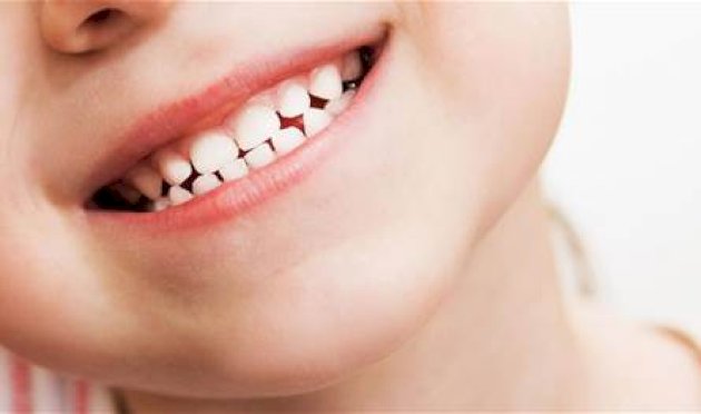 للأهل.-هكذا-يمكن-حماية-أسنان-أطفالكم-من-التسوس