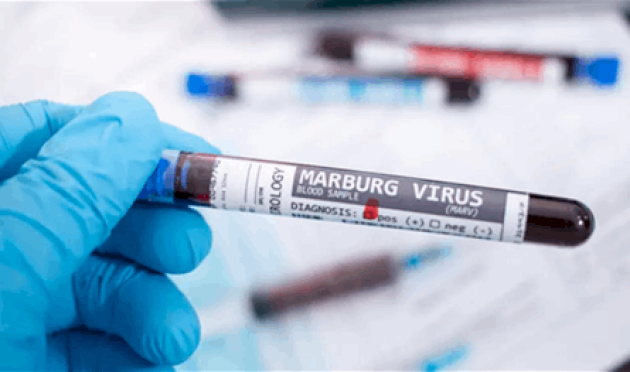 فيروس قاتل قد ينتشر… وتحذير عاجل من منظمّة الصحة العالميّة فيروس-قاتل-قد-ينتشر…-وتحذير-عاجل-من-منظمّة-الصحة-العالميّة