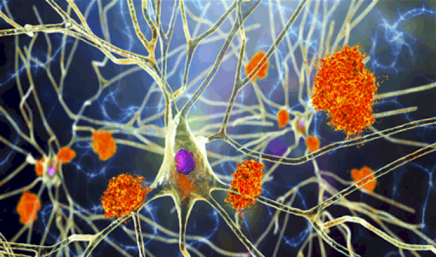 منها الفياغرا.. أدوية معروفة قد تحارب ألزهايمر ما هي؟ منها-الفياغرا.-أدوية-معروفة-قد-تحارب-ألزهايمر-ما-هي؟