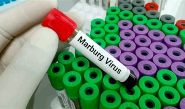 فيروس خطير جدّاً… هل بدأ بالإنتشار في هذه الدولة العربيّة؟ فيروس-خطير-جدّاً…-هل-بدأ-بالإنتشار-في-هذه-الدولة-العربيّة؟