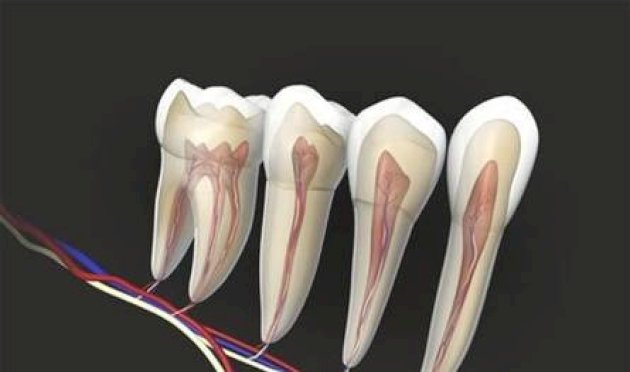علاج-عصب-الأسنان.-كيف-يساهم-في-صحة-القلب؟