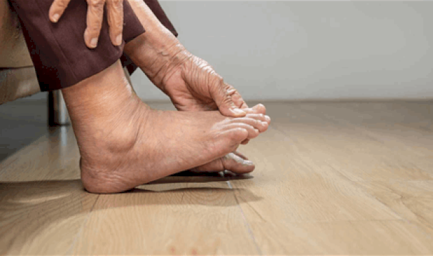 على ماذا يدل تورم الكاحل؟ على-ماذا-يدل-تورم-الكاحل؟