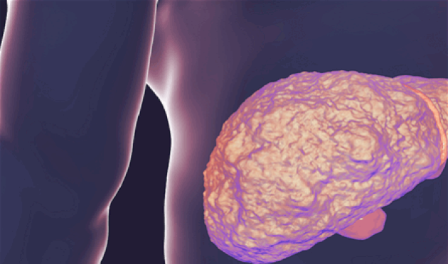 كيف-يؤثر-تليف-الكبد-على-أمراض-القلب؟