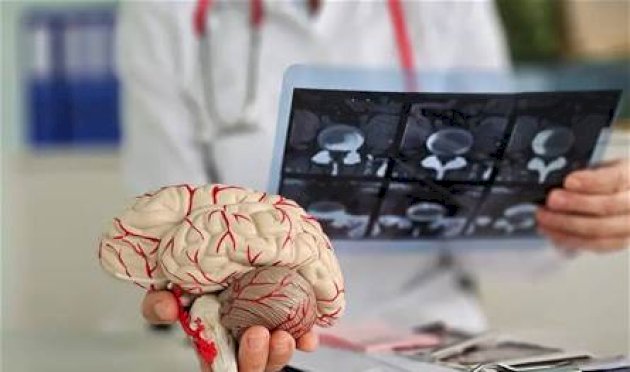 بروتين قد يحمي الدماغ من مرض الزهايمر.. اليكم آخر ما توصل اليه العلماء بروتين-قد-يحمي-الدماغ-من-مرض-الزهايمر.-اليكم-آخر-ما-توصل-اليه-العلماء