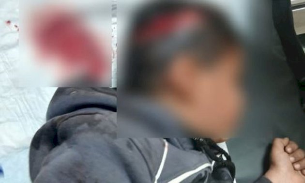 كلب-يمزّق-فروة-رأس-طفل-في-بعلبك