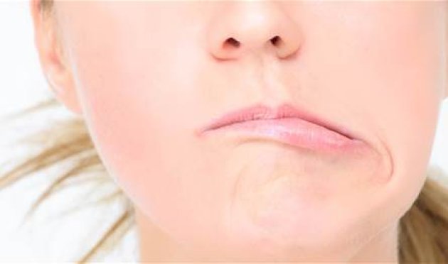 بسبب أزمة نفسية.. فنانة شهيرة تُصاب بمرض العصب السابع في وجهها (فيديو) بسبب-أزمة-نفسية.-فنانة-شهيرة-تُصاب-بمرض-العصب-السابع-في-وجهها-(فيديو)