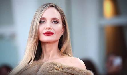 بعد-حادث-خطير…-ندوب-على-وجه-باكس-جولي-بيت-في-أول-ظهور-له