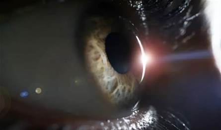 لا تنتظر ظهور الأعراض.. دراسة طبية تحذر من أمراض تسرق النظر لا-تنتظر-ظهور-الأعراض.-دراسة-طبية-تحذر-من-أمراض-تسرق-النظر