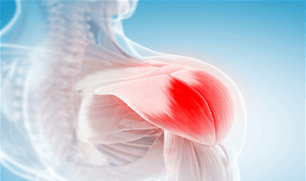 لغز أدوية "الكوليسترول" انتهى.. لماذا يشعر البعض بآلام عضلية قاتلة؟ لغز-أدوية-"الكوليسترول"-انتهى.-لماذا-يشعر-البعض-بآلام-عضلية-قاتلة؟