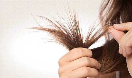 هذا-السبب-وراء-تساقط-الشعر-ومشاكل-الفروة-عند-النساء!